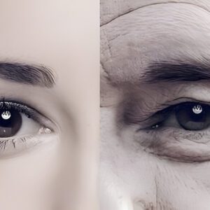 Fine lines & Wrinkles