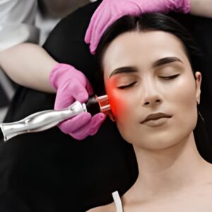 Facial Contouring (RF)