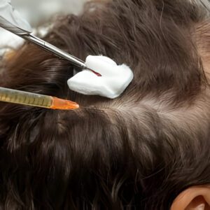 Hair Regrowth Therapy