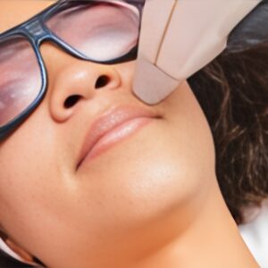 Laser Hair Reduction