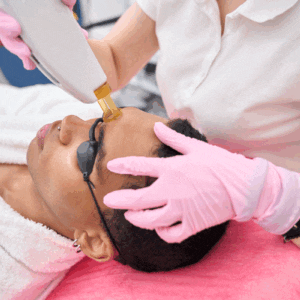 Pigmentation Removal Services