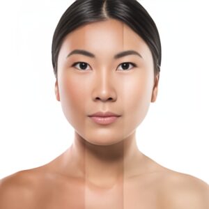 Skin Whitening